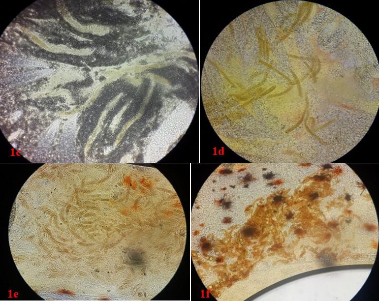 vermeform-benh-phan-trang-bio-blue-viet-nam